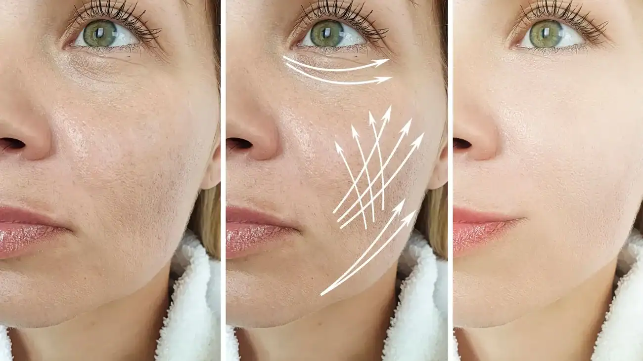 Can One Treatment Really Tackle More Than One Skin Concern Egham?