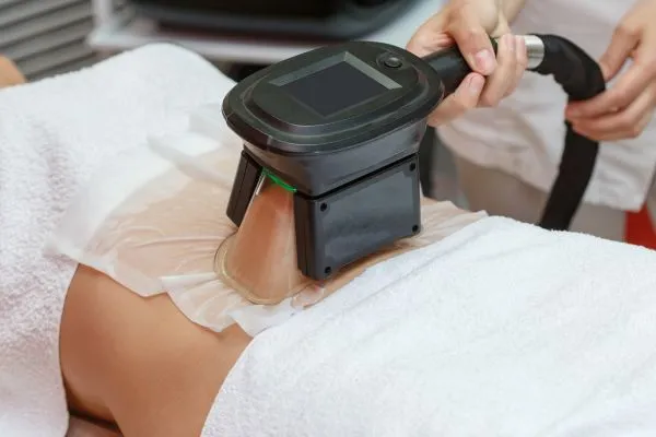 Image of person having fat freezing treatment to help weight gain Egham
