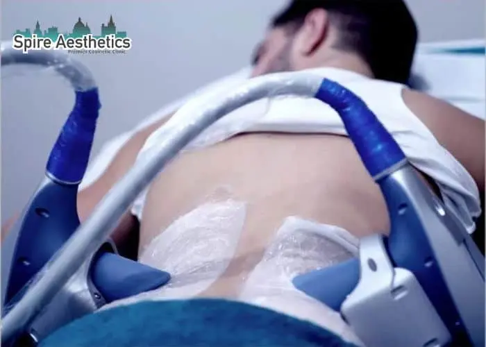 Man having fat freezing treatment done on love handles before a competitions Egham to create a sculpted look.
