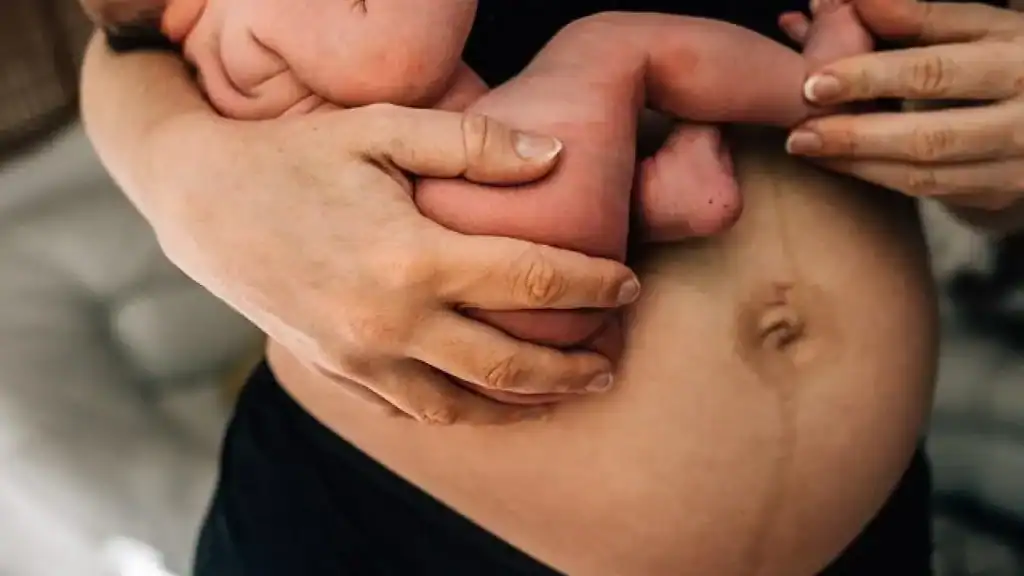 Why Is My Stomach Still Big After Pregnancy Egham?